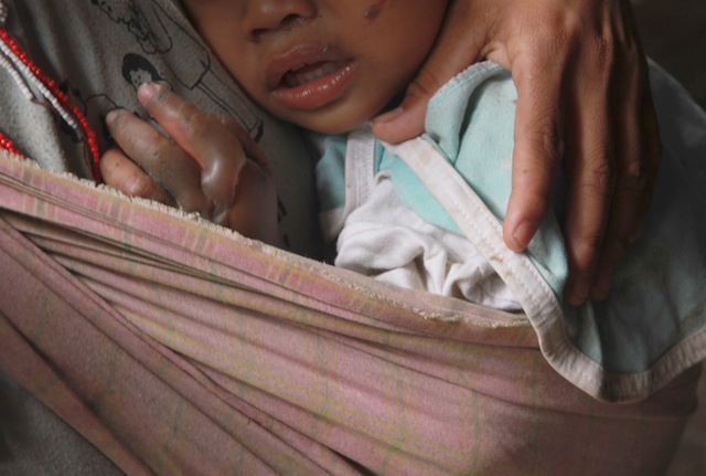 Two-year old Demon Manayab clings on to his mother in the makeshift clinic inside UCCP Haran compound, Padre Selga Street, Davao City on February 24, 2016. A fire broke at around at around 2 a.m. inside the compound where hundreds of indigenous peoples from the towns of Talaingod and Kapalong, Davao del Norte and Kitaotao, Bukidnon province are seeking refuge. MindaNews photo by TOTO LOZANO 